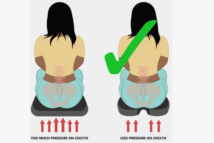 What Causes Tailbone Pain Without Any Injury?